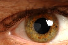 macular 000005008415xsmall